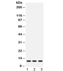 RPS27 / Ribosomal Protein S27 Antibody - Western blot testing of 1) rat spleen, 2) mouse liver and 3) human HeLa lysate with MPS1 antibody at 0.5ug/ml. Predicted/observed molecular weight ~10 kDa.