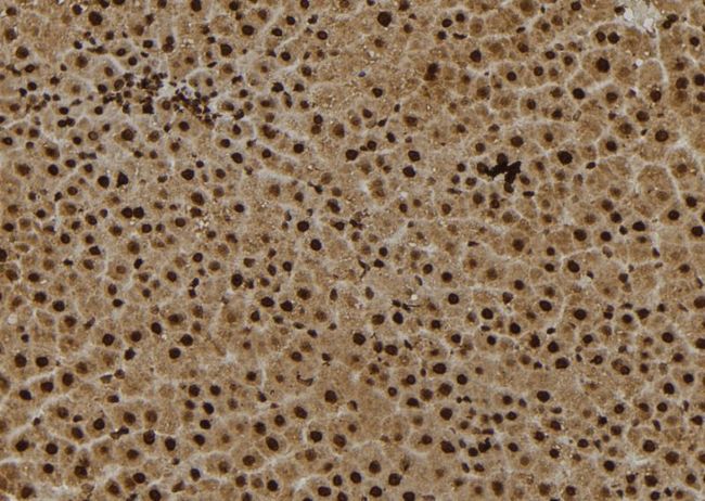 RPS27 / Ribosomal Protein S27 Antibody - 1:100 staining rat liver tissue by IHC-P. The sample was formaldehyde fixed and a heat mediated antigen retrieval step in citrate buffer was performed. The sample was then blocked and incubated with the antibody for 1.5 hours at 22°C. An HRP conjugated goat anti-rabbit antibody was used as the secondary.