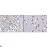 RPS27 / Ribosomal Protein S27 Antibody - Immunohistochemistry (IHC) analysis of paraffin-embedded human lung cancer (left) and Human Brain (right) tissues with DAB staining using Ribosomal Protein S27 Monoclonal Antibody.