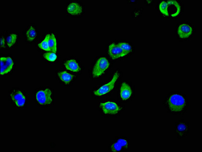 RPS27A Antibody - Immunofluorescent analysis of MCF-7 cells at a dilution of 1:100 and Alexa Fluor 488-congugated AffiniPure Goat Anti-Rabbit IgG(H+L)