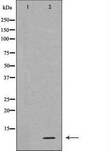 RPS27A Antibody - Western blot analysis of extracts of HL-60 cells using RPS27A antibody. The lane on the left is treated with the antigen-specific peptide.