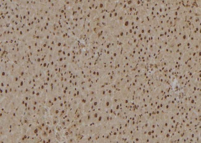 RPS27A Antibody - 1:100 staining rat liver tissue by IHC-P. The sample was formaldehyde fixed and a heat mediated antigen retrieval step in citrate buffer was performed. The sample was then blocked and incubated with the antibody for 1.5 hours at 22°C. An HRP conjugated goat anti-rabbit antibody was used as the secondary.