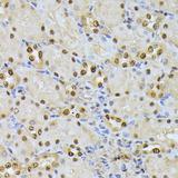 RPS27A Antibody - Immunohistochemistry of paraffin-embedded Rat kidney using RPS27A Polyclonal Antibody at dilution of 1:100 (40x lens).