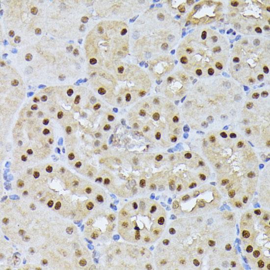 RPS27A Antibody - Immunohistochemistry of paraffin-embedded Mouse kidney using RPS27A Polyclonal Antibody at dilution of 1:100 (40x lens).
