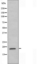 RPS27L Antibody - Western blot analysis of extracts of COLO cells using RS27L antibody.