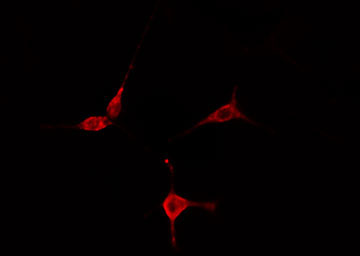 RPS27L Antibody - Staining COLO205 cells by IF/ICC. The samples were fixed with PFA and permeabilized in 0.1% Triton X-100, then blocked in 10% serum for 45 min at 25°C. The primary antibody was diluted at 1:200 and incubated with the sample for 1 hour at 37°C. An Alexa Fluor 594 conjugated goat anti-rabbit IgG (H+L) antibody, diluted at 1/600, was used as secondary antibody.