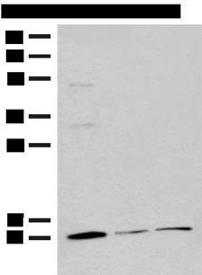 RPS27L Antibody - Western blot analysis of Mouse adrenal gland tissue Rat lung tissue 231 cell lysates  using RPS27L Polyclonal Antibody at dilution of 1:400