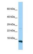 RPS28 / Ribosomal Protein S28 Antibody - RPS28 antibody Western Blot of MDA-MB-435S.  This image was taken for the unconjugated form of this product. Other forms have not been tested.