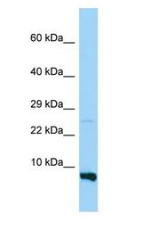 RPS28 / Ribosomal Protein S28 Antibody - RPS28 antibody Western Blot of MDA-MB-435S.  This image was taken for the unconjugated form of this product. Other forms have not been tested.