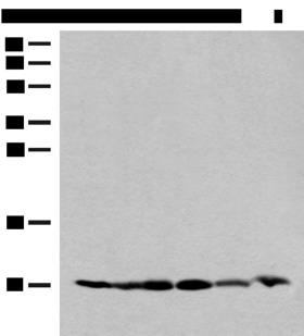 RPS28 / Ribosomal Protein S28 Antibody - Western blot analysis of 293T and PC3 cell Mouse spleen tissue 231 cell Human breast cancer tissue Mouse kidney tissue lysates  using RPS28 Polyclonal Antibody at dilution of 1:200