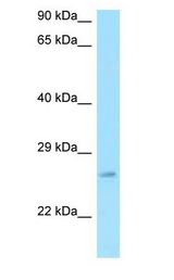 RPS3 / Ribosomal Protein S3 Antibody - S3 / RPS3 antibody Western Blot of A549.  This image was taken for the unconjugated form of this product. Other forms have not been tested.