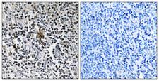 RPS3 / Ribosomal Protein S3 Antibody - Immunohistochemistry analysis of paraffin-embedded human tonsil tissue, using RPS3 Antibody. The picture on the right is blocked with the synthesized peptide.