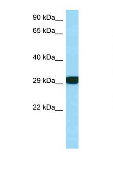 RPS3 / Ribosomal Protein S3 Antibody - RPS3 antibody Western blot of Fetal Kidney lysate. Antibody concentration 1 ug/ml.  This image was taken for the unconjugated form of this product. Other forms have not been tested.