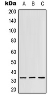RPS3 / Ribosomal Protein S3 Antibody - Western blot analysis of RPS3 expression in Jurkat (A); mouse liver (B); rat lung (C) whole cell lysates.