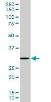 RPS3 / Ribosomal Protein S3 Antibody - RPS3 monoclonal antibody (M03), clone 2A8. Western Blot analysis of RPS3 expression in HeLa NE.