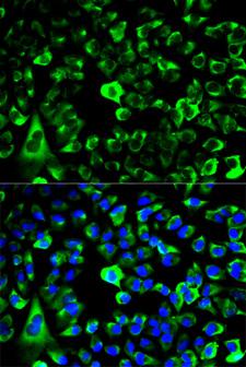 RPS3 / Ribosomal Protein S3 Antibody - Immunofluorescence analysis of HeLa cells.