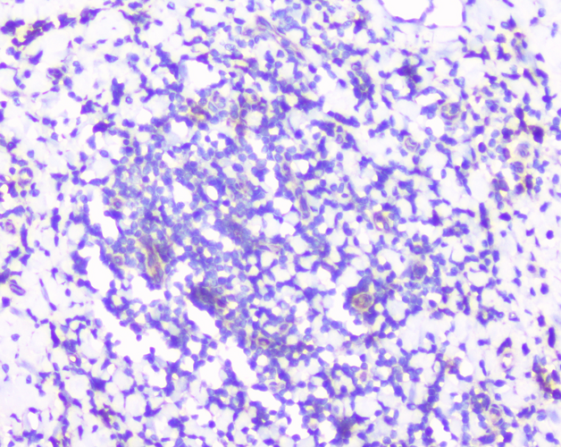 RPS3 / Ribosomal Protein S3 Antibody - IHC analysis of RPS3 using anti-RPS3 antibody. RPS3 was detected in paraffin-embedded section of human tonsil tissues. Heat mediated antigen retrieval was performed in citrate buffer (pH6, epitope retrieval solution) for 20 mins. The tissue section was blocked with 10% goat serum. The tissue section was then incubated with 1µg/ml rabbit anti-RPS3 Antibody overnight at 4°C. Biotinylated goat anti-rabbit IgG was used as secondary antibody and incubated for 30 minutes at 37°C. The tissue section was developed using Strepavidin-Biotin-Complex (SABC) with DAB as the chromogen.