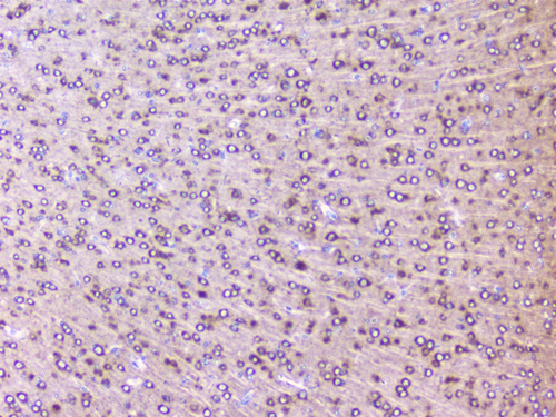 RPS3 / Ribosomal Protein S3 Antibody - IHC analysis of RPS3 using anti-RPS3 antibody. RPS3 was detected in paraffin-embedded section of mouse brain tissues. Heat mediated antigen retrieval was performed in citrate buffer (pH6, epitope retrieval solution) for 20 mins. The tissue section was blocked with 10% goat serum. The tissue section was then incubated with 1µg/ml rabbit anti-RPS3 Antibody overnight at 4°C. Biotinylated goat anti-rabbit IgG was used as secondary antibody and incubated for 30 minutes at 37°C. The tissue section was developed using Strepavidin-Biotin-Complex (SABC) with DAB as the chromogen.