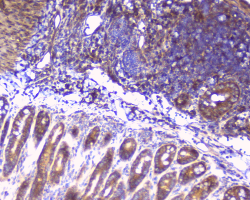 RPS3 / Ribosomal Protein S3 Antibody - IHC analysis of RPS3 using anti-RPS3 antibody. RPS3 was detected in paraffin-embedded section of mouse intestine tissues. Heat mediated antigen retrieval was performed in citrate buffer (pH6, epitope retrieval solution) for 20 mins. The tissue section was blocked with 10% goat serum. The tissue section was then incubated with 1µg/ml rabbit anti-RPS3 Antibody overnight at 4°C. Biotinylated goat anti-rabbit IgG was used as secondary antibody and incubated for 30 minutes at 37°C. The tissue section was developed using Strepavidin-Biotin-Complex (SABC) with DAB as the chromogen.