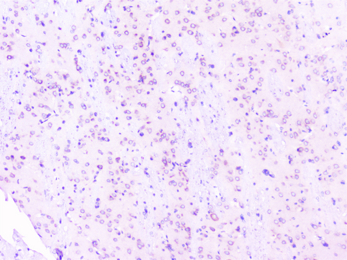RPS3 / Ribosomal Protein S3 Antibody - IHC analysis of RPS3 using anti-RPS3 antibody. RPS3 was detected in paraffin-embedded section of rat brain tissues. Heat mediated antigen retrieval was performed in citrate buffer (pH6, epitope retrieval solution) for 20 mins. The tissue section was blocked with 10% goat serum. The tissue section was then incubated with 1µg/ml rabbit anti-RPS3 Antibody overnight at 4°C. Biotinylated goat anti-rabbit IgG was used as secondary antibody and incubated for 30 minutes at 37°C. The tissue section was developed using Strepavidin-Biotin-Complex (SABC) with DAB as the chromogen.