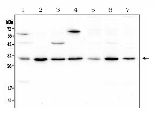 RPS3 / Ribosomal Protein S3 Antibody - Western blot analysis of RPS3 using anti-RPS3 antibody. Electrophoresis was performed on a 5-20% SDS-PAGE gel at 70V (Stacking gel) / 90V (Resolving gel) for 2-3 hours. The sample well of each lane was loaded with 50ug of sample under reducing conditions. Lane 1: human placenta tissue lysates, Lane 2: human HL-60 whole cell lysate, Lane 3: human Caco-2 whole cell lysate, Lane 4: human K562 whole cell lysate, Lane 5: human U2OS whole cell lysate, Lane 6: human MCF-7 whole cell lysate, Lane 7: human PC-3 whole cell lysate. After Electrophoresis, proteins were transferred to a Nitrocellulose membrane at 150mA for 50-90 minutes. Blocked the membrane with 5% Non-fat Milk/ TBS for 1.5 hour at RT. The membrane was incubated with rabbit anti-RPS3 antigen affinity purified polyclonal antibody at 0.5 µg/mL overnight at 4°C, then washed with TBS-0.1% Tween 3 times with 5 minutes each and probed with a goat anti-rabbit IgG-HRP secondary antibody at a dilution of 1:10000 for 1.5 hour at RT. The signal is developed using an Enhanced Chemiluminescent detection (ECL) kit with Tanon 5200 system. A specific band was detected for RPS3 at approximately 31KD. The expected band size for RPS3 is at 27KD.