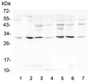 RPS3 / Ribosomal Protein S3 Antibody - Western blot testing of human 1) placenta 2) HL-60, 3) Caco-2, 4) T-47D, 5) K562, 6) HepG2 and 7) A431 lysate with RPS3 antibody at 0.5ug/ml. Predicted molecular weight ~27 kDa.