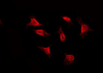 RPS3 / Ribosomal Protein S3 Antibody - Staining HepG2 cells by IF/ICC. The samples were fixed with PFA and permeabilized in 0.1% Triton X-100, then blocked in 10% serum for 45 min at 25°C. The primary antibody was diluted at 1:200 and incubated with the sample for 1 hour at 37°C. An Alexa Fluor 594 conjugated goat anti-rabbit IgG (H+L) Ab, diluted at 1/600, was used as the secondary antibody.