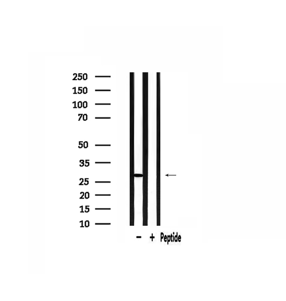RPS3 / Ribosomal Protein S3 Antibody - Western blot analysis of extracts of 293 cells using RPS3 antibody.