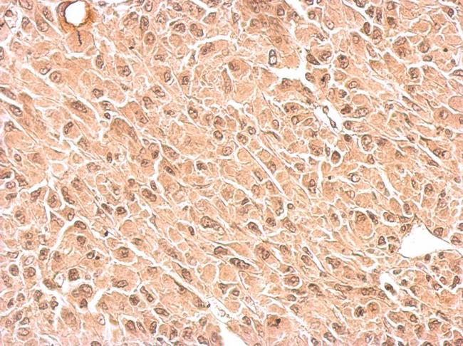 RPS3A / Ribosomal Protein S3A Antibody - RPS3A antibody detects RPS3A protein at cytosol and nucleus on U87 xenograft by immunohistochemical analysis. Sample: Paraffin-embedded U87 xenograft. RPS3A antibody dilution:1:500.