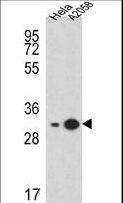 RPS3A / Ribosomal Protein S3A Antibody - RPS3A Antibody western blot of HeLa,A2058 cell line lysates (15 ug/lane). The RPS3A antibody detected the RPS3A protein (arrow).