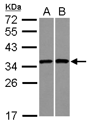 RPS3A / Ribosomal Protein S3A Antibody - Sample (30 ug of whole cell lysate) A: A431 B: Raji 12% SDS PAGE RPS3A antibody diluted at 1:1000