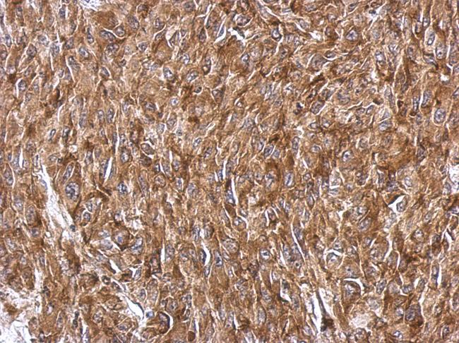 RPS3A / Ribosomal Protein S3A Antibody - IHC of paraffin-embedded RT2 xenograft, using RPS3A antibody antibody at 1:500 dilution.