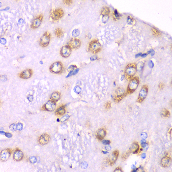 RPS3A / Ribosomal Protein S3A Antibody - Immunohistochemistry of paraffin-embedded rat brain tissue.