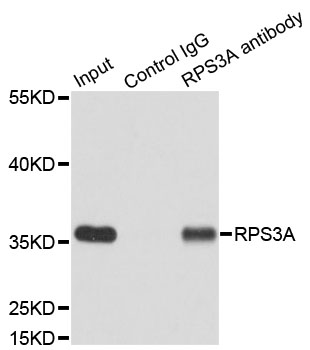 RPS3A / Ribosomal Protein S3A Antibody - Immunoprecipitation analysis of 200ug extracts of MCF7 cells.