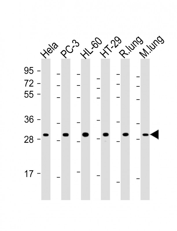 RPS4X Antibody - All lanes: Anti-RPS4X Antibody (C-Term) at 1:2000 dilution Lane 1: Hela whole cell lysate Lane 2: PC-3 whole cell lysate Lane 3: HL-60 whole cell lysate Lane 4: HT-29 whole cell lysate Lane 5: rat lung lysate Lane 6: mouse lung lysate Lysates/proteins at 20 µg per lane. Secondary Goat Anti-Rabbit IgG, (H+L), Peroxidase conjugated at 1/10000 dilution. Predicted band size: 30 kDa Blocking/Dilution buffer: 5% NFDM/TBST.