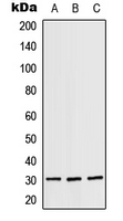 RPS4X Antibody - Western blot analysis of RPS4X expression in A431 (A); SP2/0 (B); H9C2 (C) whole cell lysates.