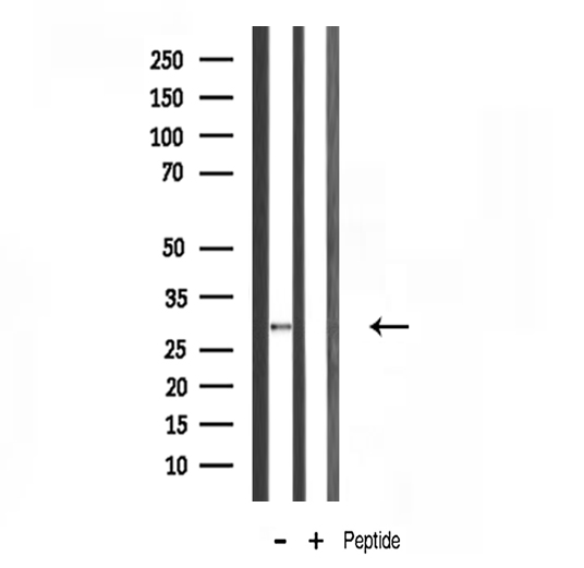 RPS4X Antibody - Western blot analysis of RPS4X expression in mouse kidney lysate