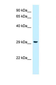 RPS4X + RPS4Y1 + RPS Antibody - RPS4Y1 antibody Western blot of 293T Cell lysate. Antibody concentration 1 ug/ml.  This image was taken for the unconjugated form of this product. Other forms have not been tested.