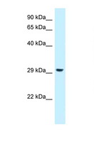 RPS4X + RPS4Y1 + RPS Antibody - RPS4Y1 antibody Western blot of 293T Cell lysate. Antibody concentration 1 ug/ml.  This image was taken for the unconjugated form of this product. Other forms have not been tested.
