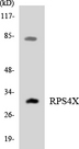 RPS4X + RPS4Y1 + RPS Antibody - Western blot analysis of the lysates from HT-29 cells using RPS4X antibody.