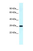 RPS4X + RPS4Y1 + RPS Antibody - RPS4Y1 antibody Western blot of Fetal Lung lysate. Antibody concentration 1 ug/ml.  This image was taken for the unconjugated form of this product. Other forms have not been tested.