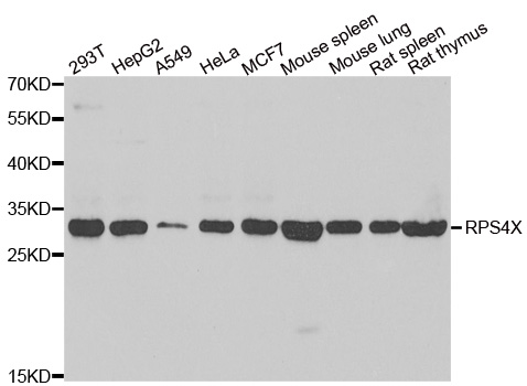 RPS4X + RPS4Y1 + RPS Antibody - Western blot analysis of extracts of various cell lines.