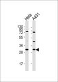 RPS4X + RPS4Y1 + RPS Antibody - All lanes : Anti-RPS4X Antibody at 1:1000 dilution Lane 1: HeLa whole cell lysates Lane 2: A431 whole cell lysates Lysates/proteins at 20 ug per lane. Secondary Goat Anti-Rabbit IgG, (H+L),Peroxidase conjugated at 1/10000 dilution Predicted band size : 30 kDa Blocking/Dilution buffer: 5% NFDM/TBST.