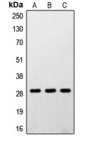 RPS4Y1 Antibody - Western blot analysis of RPS4Y1 expression in A431 (A); K562 (B); HEK293 (C) whole cell lysates.