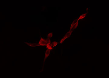 RPS4Y1 Antibody - Staining HuvEc cells by IF/ICC. The samples were fixed with PFA and permeabilized in 0.1% Triton X-100, then blocked in 10% serum for 45 min at 25°C. The primary antibody was diluted at 1:200 and incubated with the sample for 1 hour at 37°C. An Alexa Fluor 594 conjugated goat anti-rabbit IgG (H+L) antibody, diluted at 1/600, was used as secondary antibody.