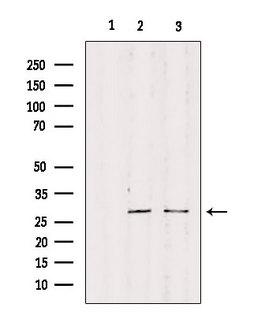RPS4Y1 Antibody - Western blot analysis of extracts of various samples using RPS4Y1 antibody. Lane 1: mouse carcinoma treated with blocking peptide. Lane 2: mouse carcinoma; Lane 3: 293;