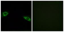 RPS4Y1 Antibody - Peptide - + Immunofluorescence analysis of HuvEc cells, using RPS4Y1 antibody.