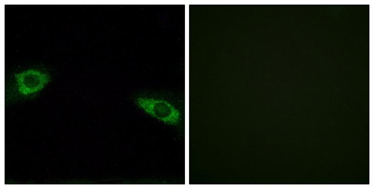 RPS4Y1 Antibody - Peptide - + Immunofluorescence analysis of HuvEc cells, using RPS4Y1 antibody.