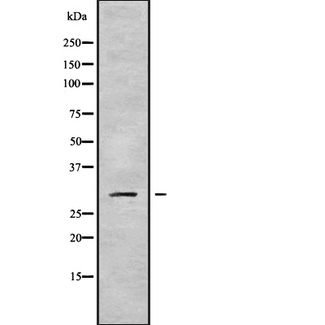 RPS4Y2 Antibody - Western blot analysis of RPS4Y1/2 using LOVO cells whole cells lysates