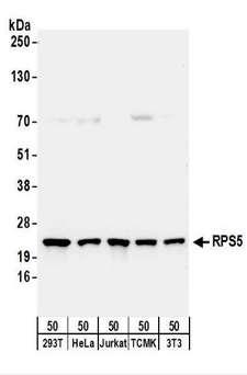 RPS5 / Ribosomal Protein S5 Antibody - Detection of Human and Mouse RPS5 by Western Blot. Samples: Whole cell lysate (50 ug) from 293T, HeLa, Jurkat, mouse TCMK-1, and mouse NIH3T3 cells. Antibodies: Affinity purified rabbit anti-RPS5 antibody used for WB at 0.1 ug/ml. Detection: Chemiluminescence with an exposure time of 30 seconds.